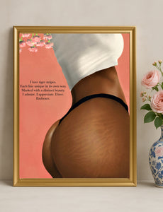 STRETCH MARKS Poster