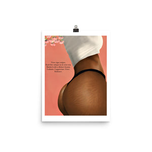 STRETCH MARKS Poster